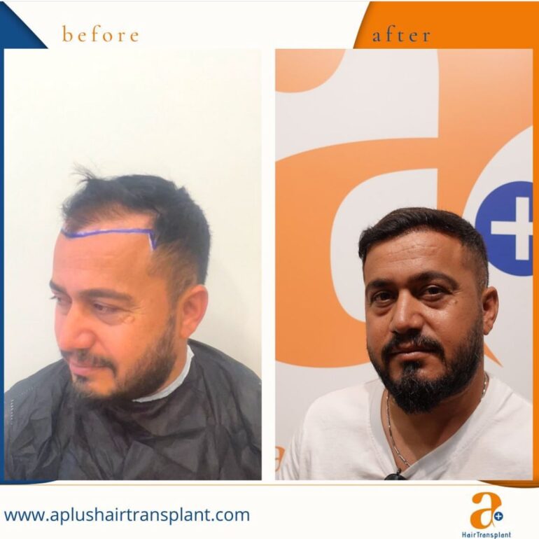 WhatsApp Image 2023-01-19 at 14.55.18 (2)